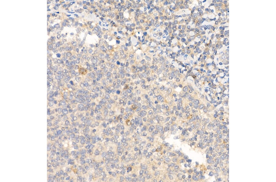 Immunohistochemistry - Anti-IL-21 Antibody (A16894) - Antibodies.com