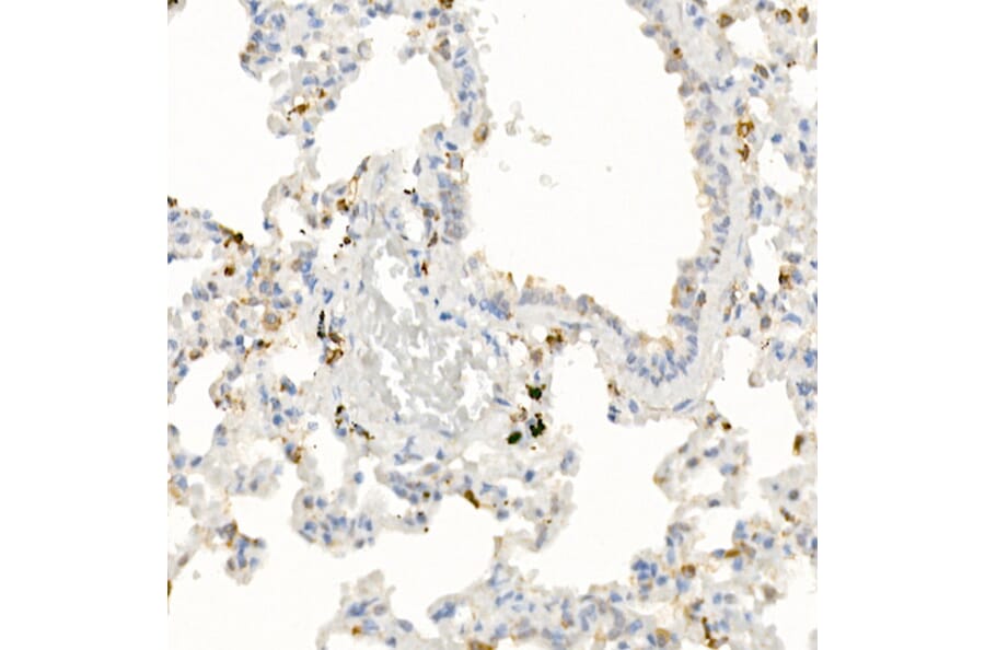 Immunohistochemistry - Anti-IL-21 Antibody (A16894) - Antibodies.com