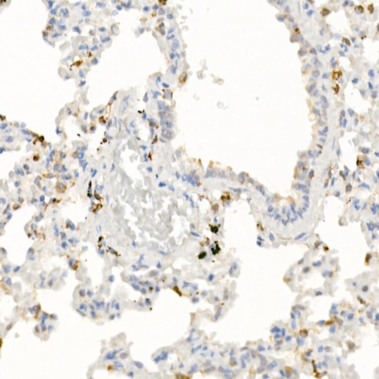 Immunohistochemistry - Anti-IL-21 Antibody (A16894) - Antibodies.com