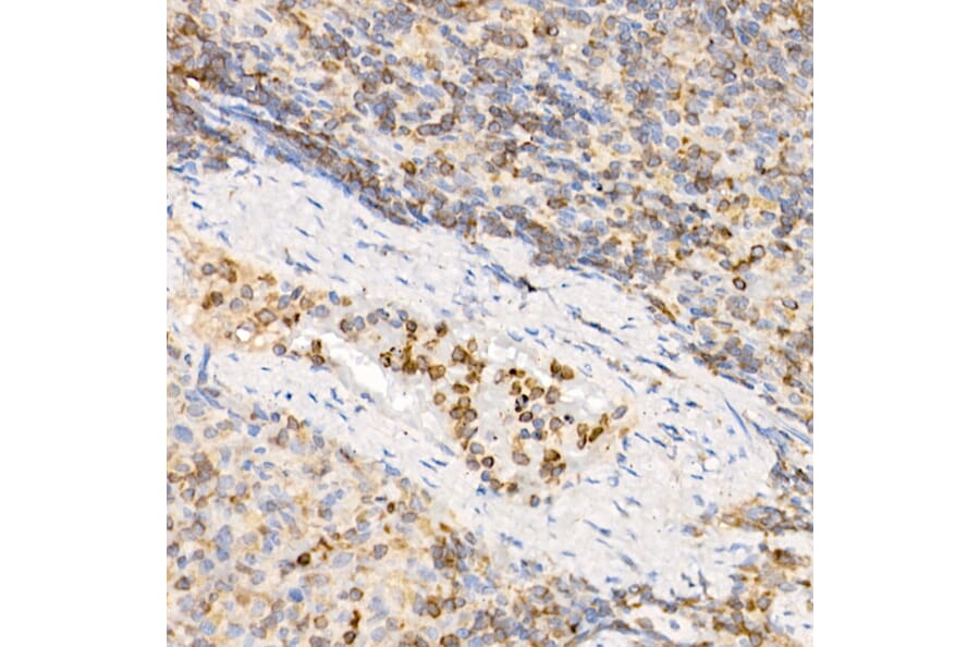 Immunohistochemistry - Anti-IL-21 Antibody (A16894) - Antibodies.com