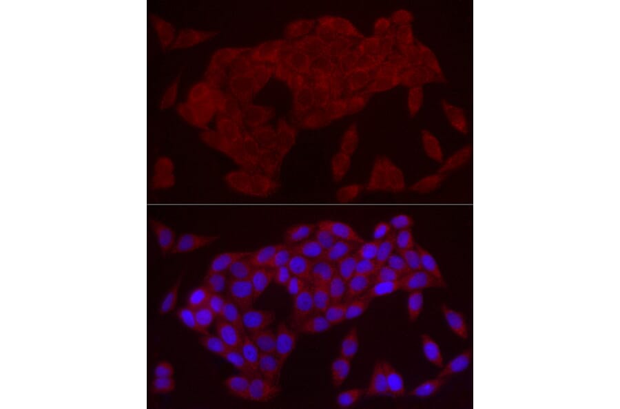 Immunofluorescence - Anti-IL-21 Antibody (A16894) - Antibodies.com
