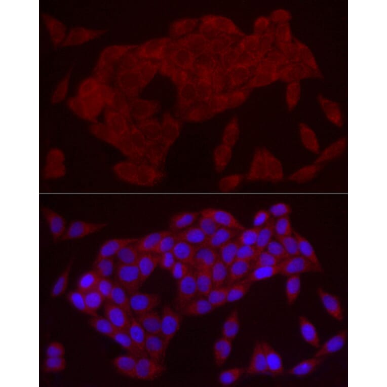 Immunofluorescence - Anti-IL-21 Antibody (A16894) - Antibodies.com