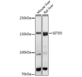 Western Blot - Anti-SETD5 Antibody (A16895) - Antibodies.com