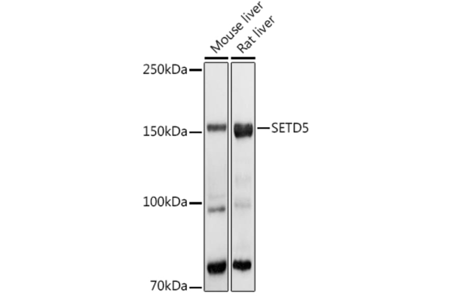 Western Blot - Anti-SETD5 Antibody (A16895) - Antibodies.com