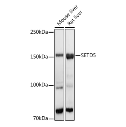 Western Blot - Anti-SETD5 Antibody (A16895) - Antibodies.com