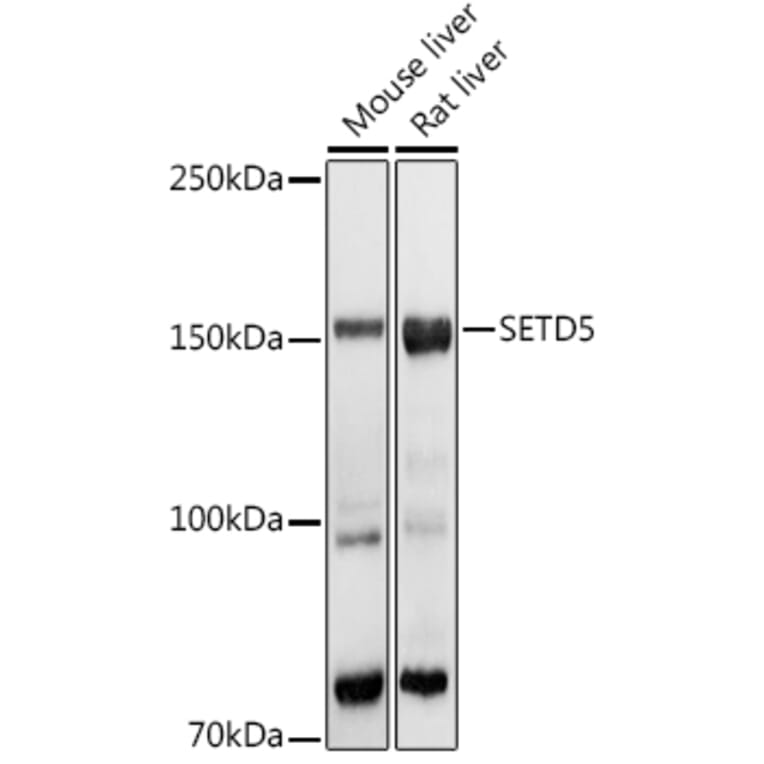 Western Blot - Anti-SETD5 Antibody (A16895) - Antibodies.com