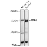 Western Blot - Anti-SETD5 Antibody (A16895) - Antibodies.com