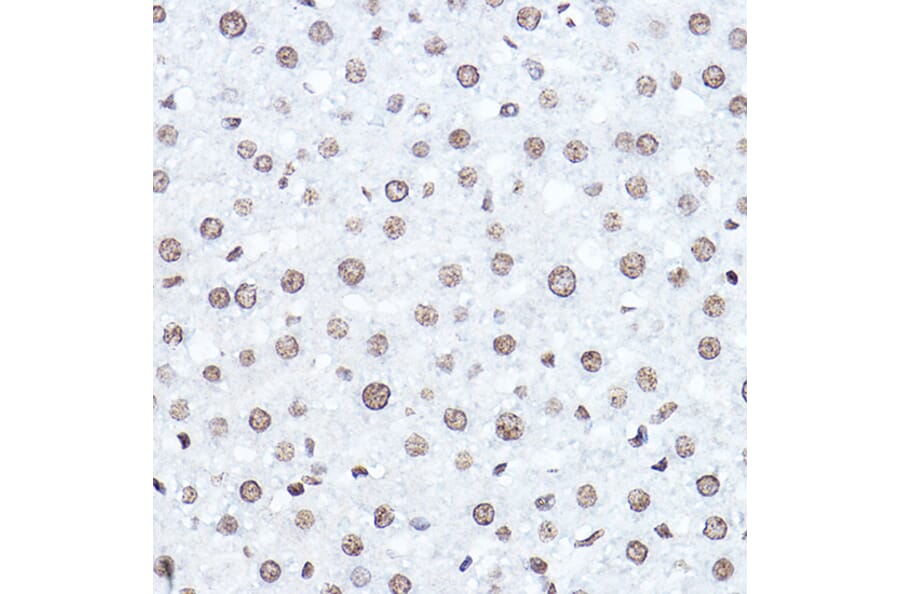 Immunohistochemistry - Anti-SETD5 Antibody (A16895) - Antibodies.com