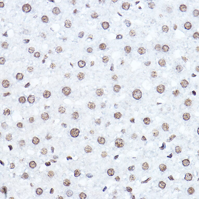 Immunohistochemistry - Anti-SETD5 Antibody (A16895) - Antibodies.com