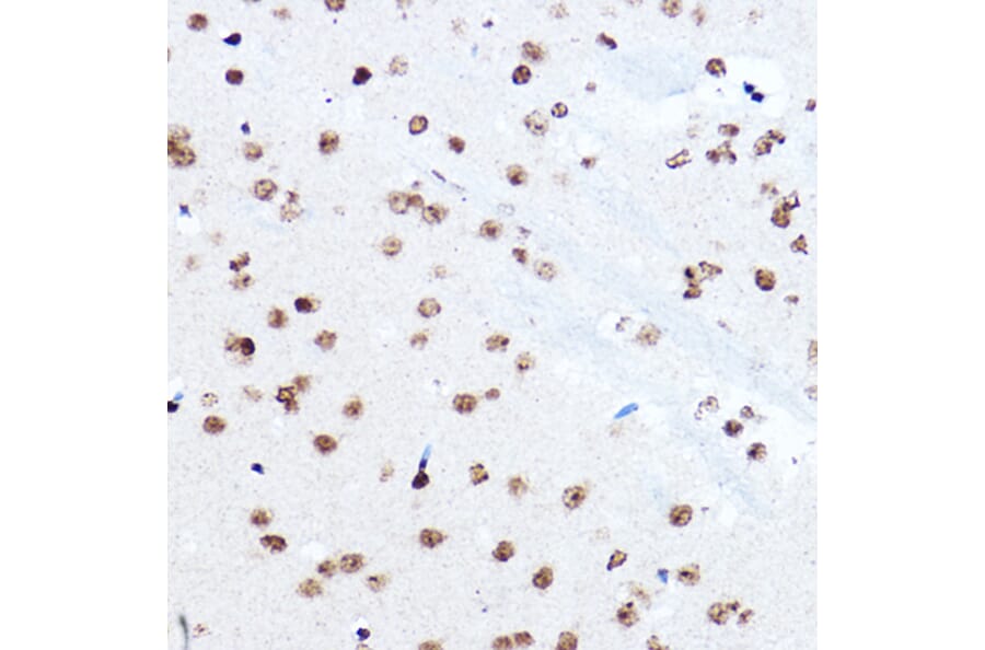 Immunohistochemistry - Anti-SETD5 Antibody (A16895) - Antibodies.com