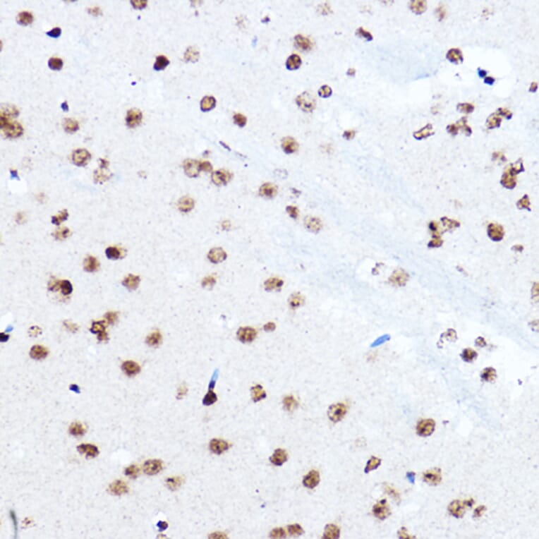 Immunohistochemistry - Anti-SETD5 Antibody (A16895) - Antibodies.com