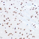 Immunohistochemistry - Anti-SETD5 Antibody (A16895) - Antibodies.com