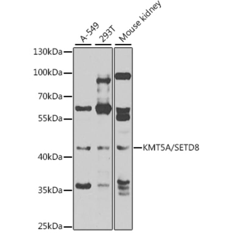 Western Blot - Anti-KMT5A/SETD8/Pr-SET7 Antibody (A16896) - Antibodies.com