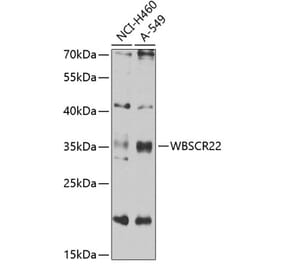 Western Blot - Anti-WBSCR22 Antibody (A16897) - Antibodies.com