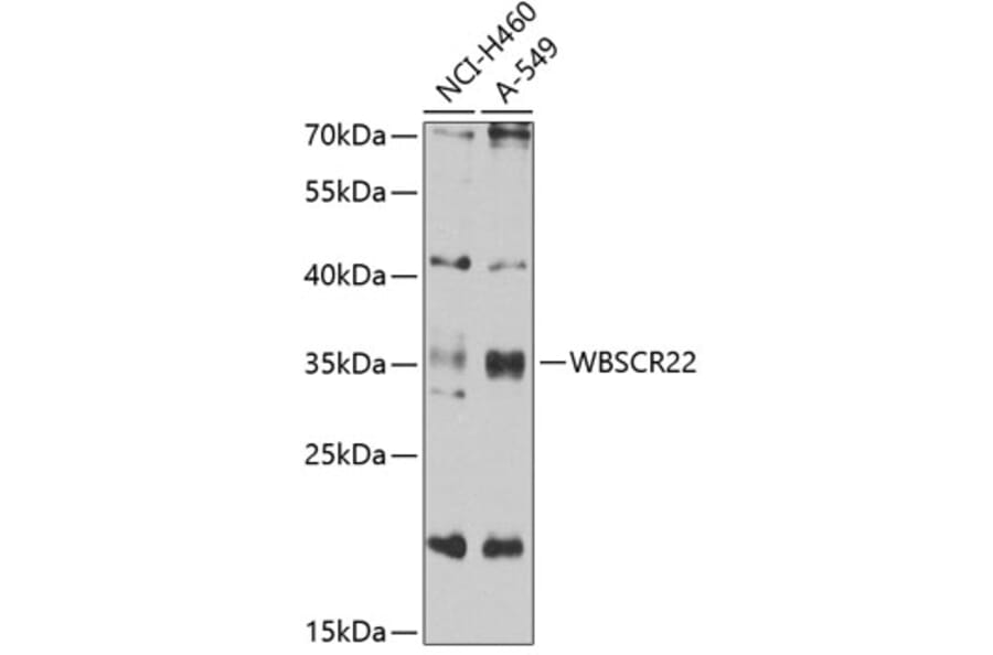 Western Blot - Anti-WBSCR22 Antibody (A16897) - Antibodies.com