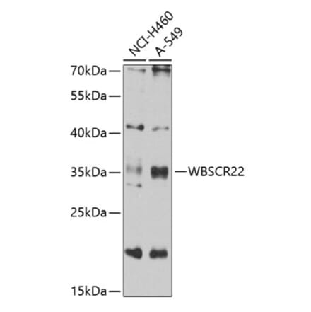 Western Blot - Anti-WBSCR22 Antibody (A16897) - Antibodies.com