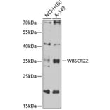 Western Blot - Anti-WBSCR22 Antibody (A16897) - Antibodies.com