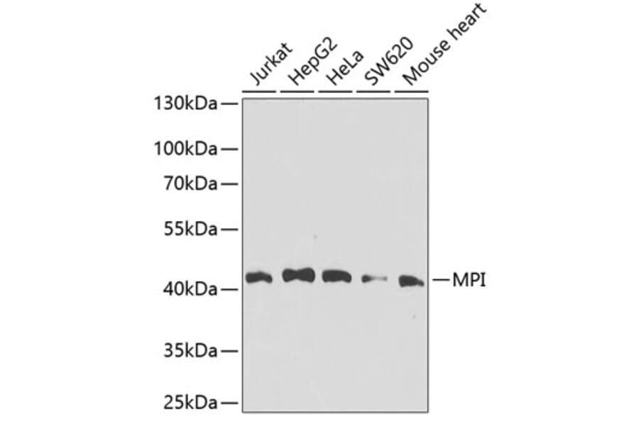 Western Blot - Anti-MPI/Mannose Phosphate Isomerase Antibody (A16898) - Antibodies.com