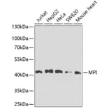 Western Blot - Anti-MPI/Mannose Phosphate Isomerase Antibody (A16898) - Antibodies.com