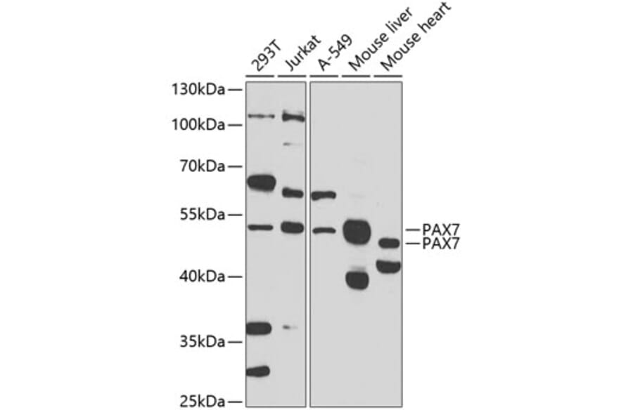 Western Blot - Anti-PAX7 Antibody (A16899) - Antibodies.com