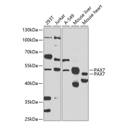 Western Blot - Anti-PAX7 Antibody (A16899) - Antibodies.com