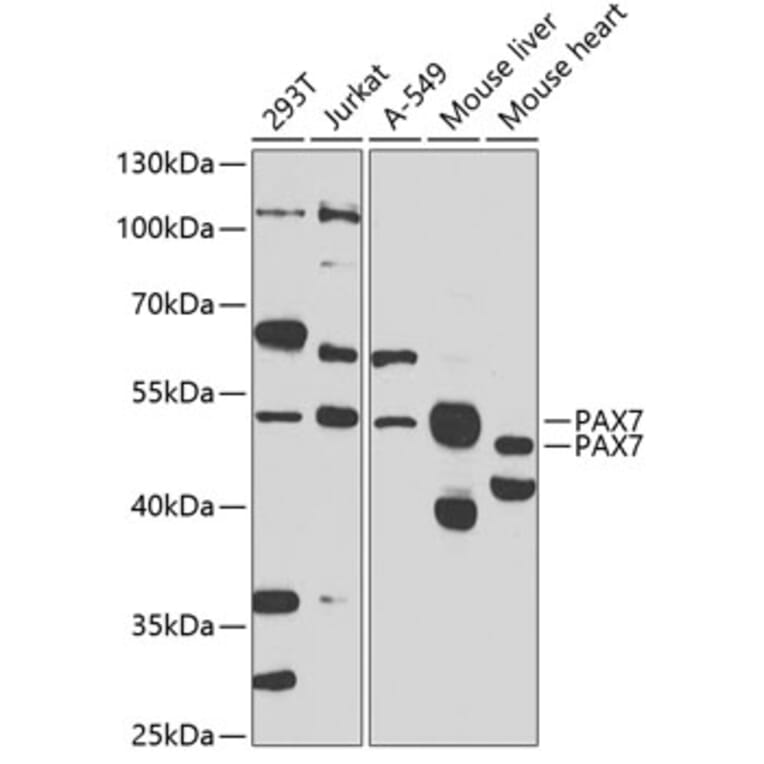 Western Blot - Anti-PAX7 Antibody (A16899) - Antibodies.com