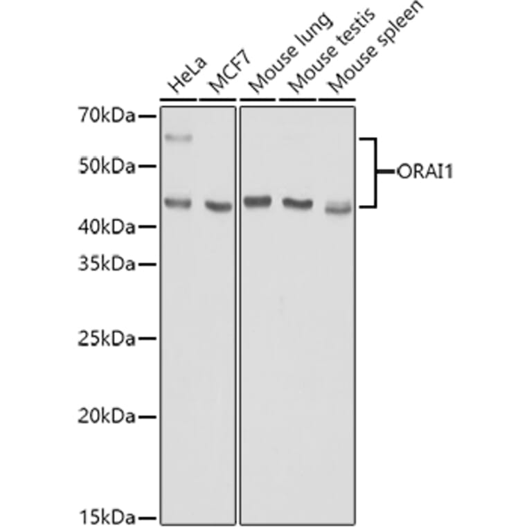 Western Blot - Anti-Orai1 Antibody (A16900) - Antibodies.com
