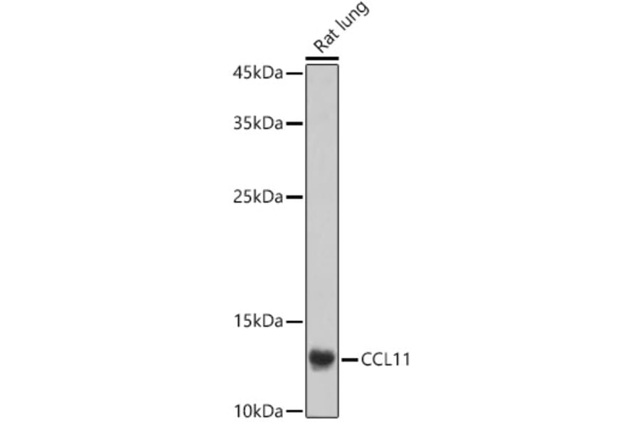 Western Blot - Anti-Eotaxin Antibody (A16902) - Antibodies.com