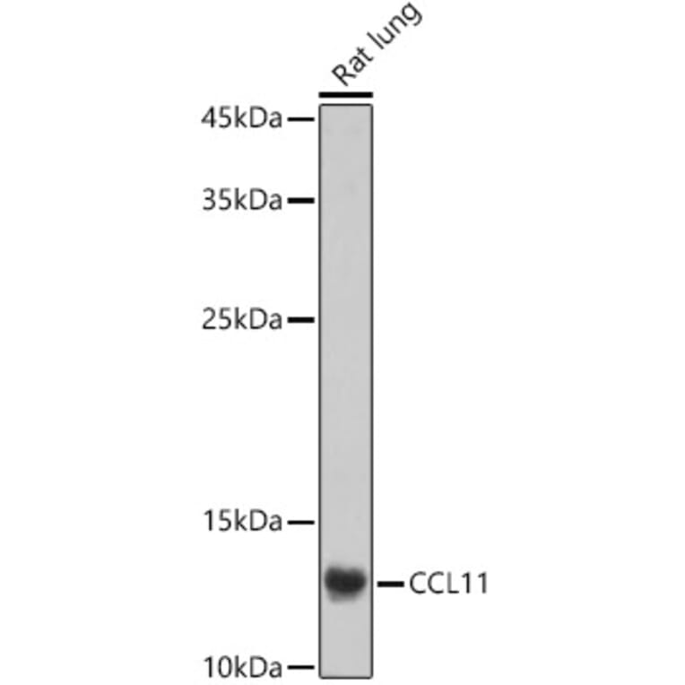 Western Blot - Anti-Eotaxin Antibody (A16902) - Antibodies.com