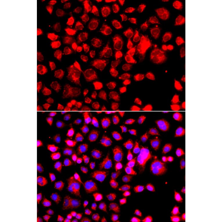 Immunofluorescence - Anti-Eotaxin Antibody (A16902) - Antibodies.com