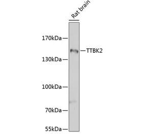 Western Blot - Anti-TTBK2 Antibody (A16905) - Antibodies.com