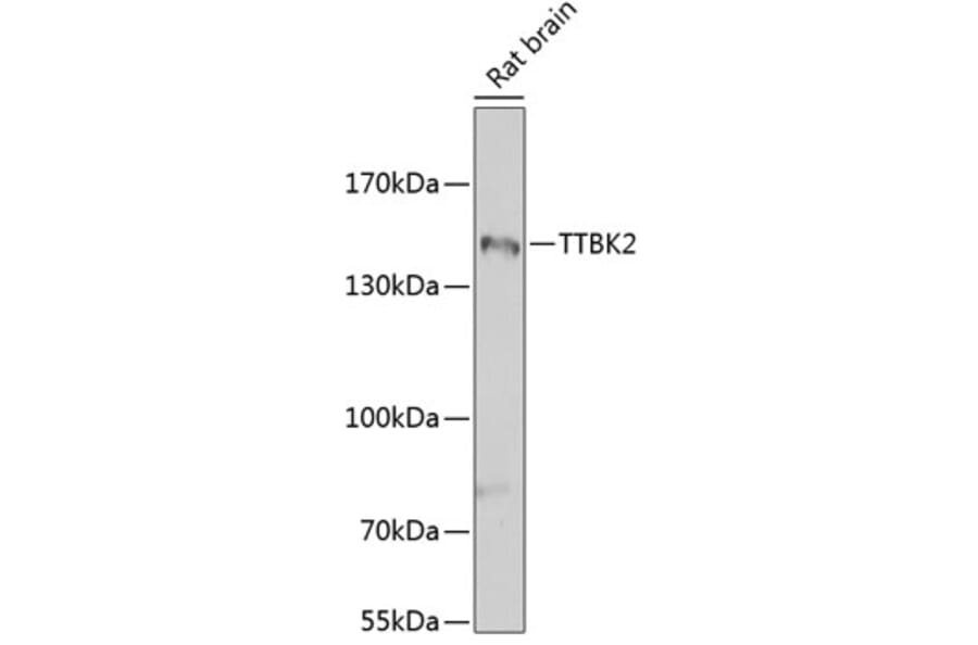 Western Blot - Anti-TTBK2 Antibody (A16905) - Antibodies.com