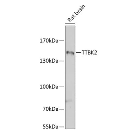 Western Blot - Anti-TTBK2 Antibody (A16905) - Antibodies.com