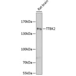 Western Blot - Anti-TTBK2 Antibody (A16905) - Antibodies.com
