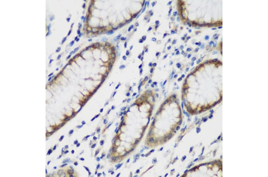 Immunohistochemistry - Anti-TTBK2 Antibody (A16905) - Antibodies.com