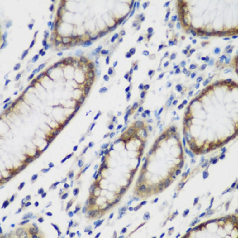 Immunohistochemistry - Anti-TTBK2 Antibody (A16905) - Antibodies.com