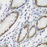 Immunohistochemistry - Anti-TTBK2 Antibody (A16905) - Antibodies.com