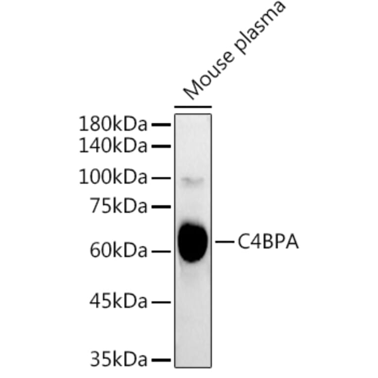 Western Blot - Anti-C4BPA Antibody (A16907) - Antibodies.com
