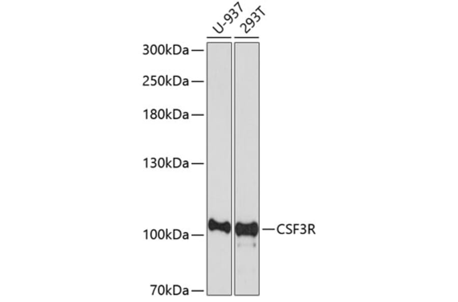 Western Blot - Anti-GCSF Receptor Antibody (A16908) - Antibodies.com