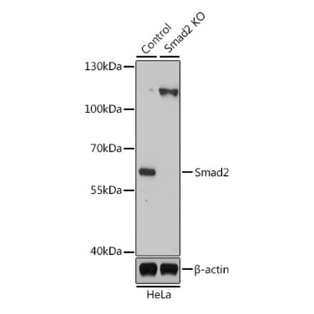Western Blot - Anti-Smad2 Antibody (A16909) - Antibodies.com