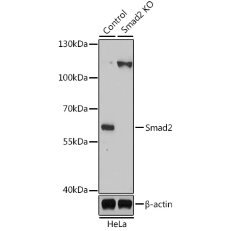 Western Blot - Anti-Smad2 Antibody (A16909) - Antibodies.com