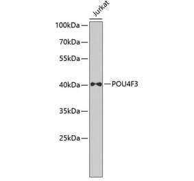Western Blot - Anti-POU4F3 Antibody (A7712) - Antibodies.com