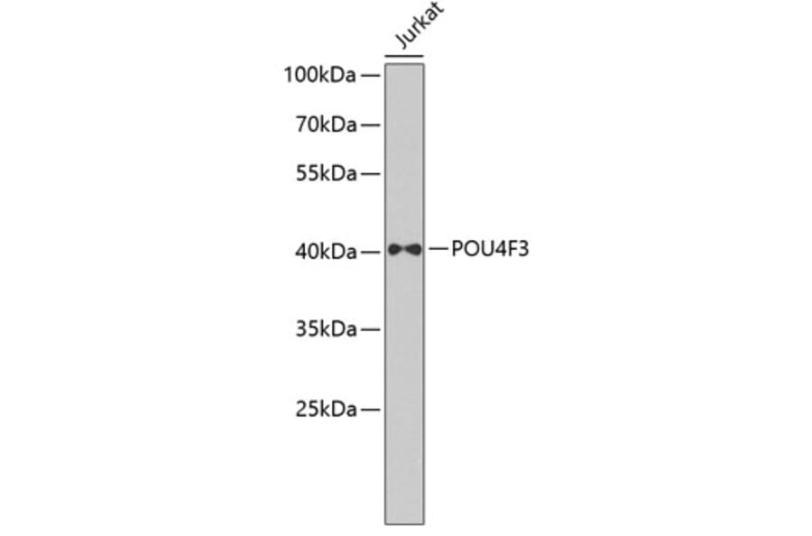 Western Blot - Anti-POU4F3 Antibody (A7712) - Antibodies.com