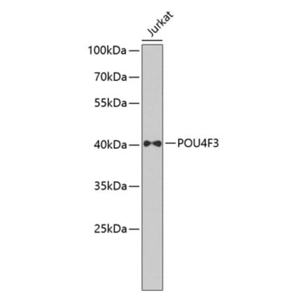Western Blot - Anti-POU4F3 Antibody (A7712) - Antibodies.com