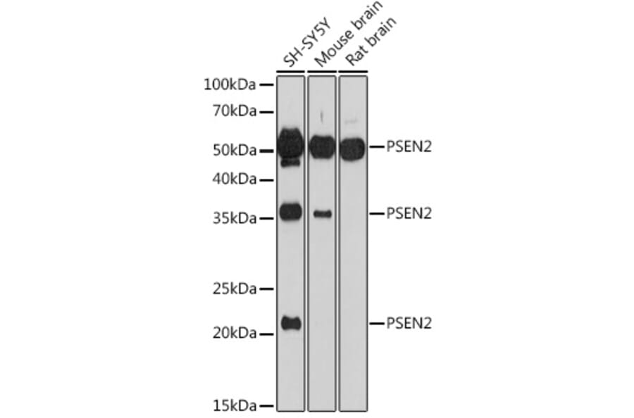 Western Blot - Anti-Presenilin 2/AD5 Antibody (A16911) - Antibodies.com