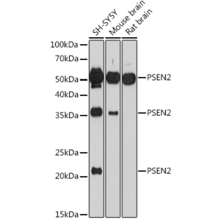 Western Blot - Anti-Presenilin 2/AD5 Antibody (A16911) - Antibodies.com