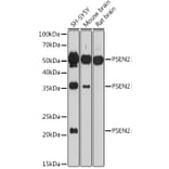 Western Blot - Anti-Presenilin 2/AD5 Antibody (A16911) - Antibodies.com