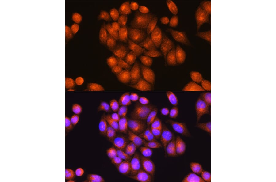 Immunofluorescence - Anti-Presenilin 2/AD5 Antibody (A16911) - Antibodies.com
