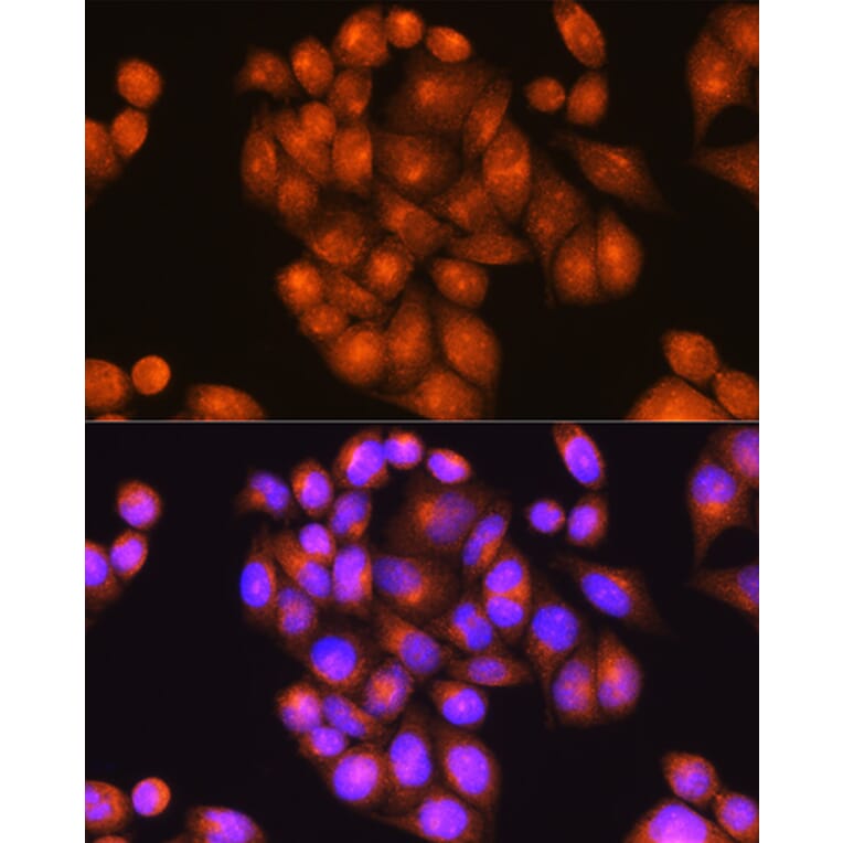 Immunofluorescence - Anti-Presenilin 2/AD5 Antibody (A16911) - Antibodies.com