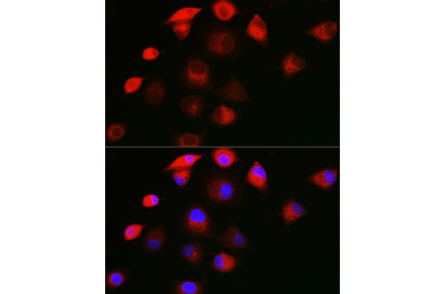 Immunofluorescence - Anti-SHC Antibody (A16912) - Antibodies.com